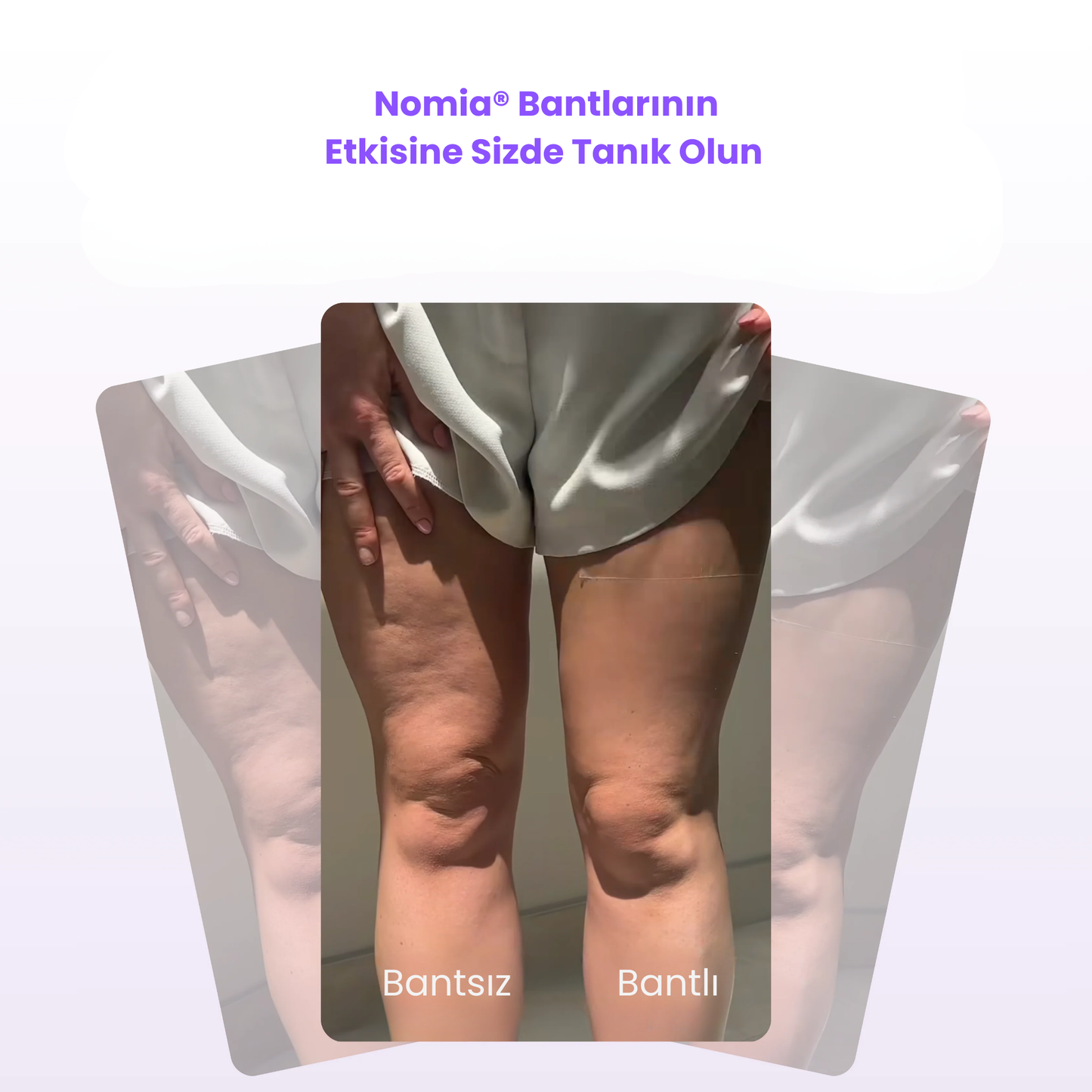 Nomia® Selülit Bantı