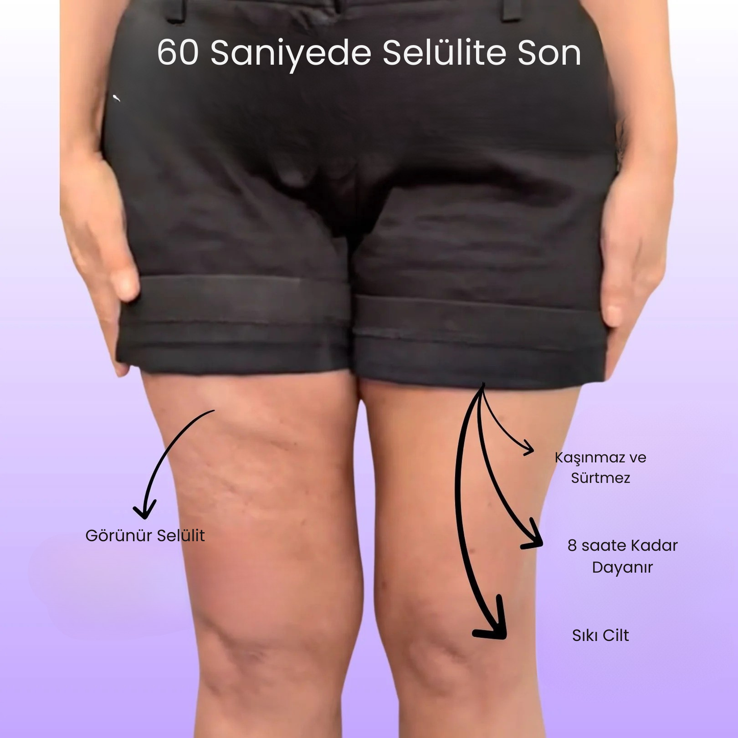 Nomia® Selülit Bantı