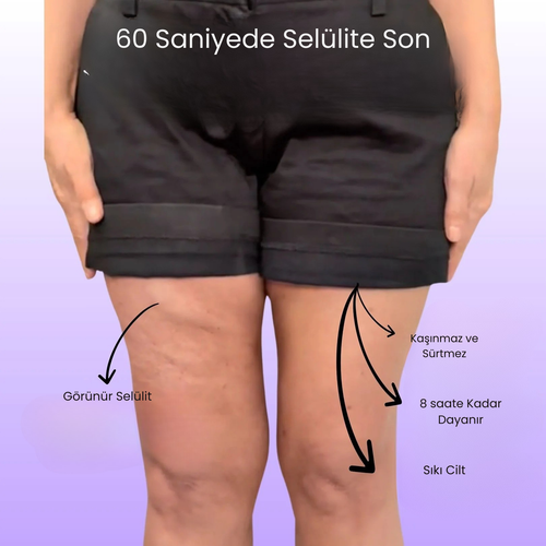 Nomia® Selülit Bantı