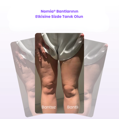 Nomia® Selülit Bantı